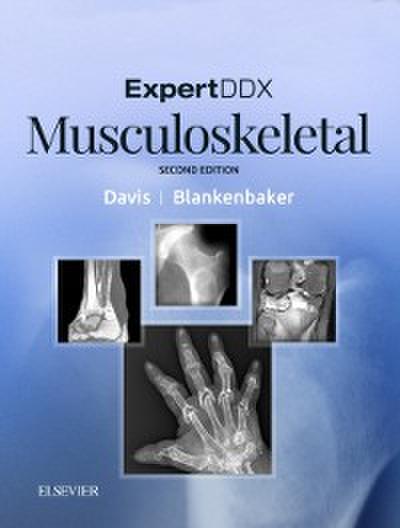 ExpertDDx: Musculoskeletal