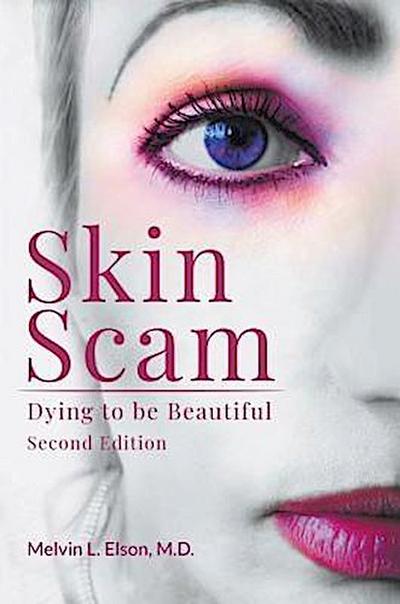 Skin Scam