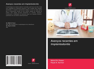 Avanços recentes em Implantodontia