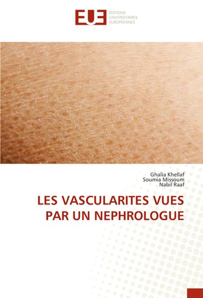 LES VASCULARITES VUES PAR UN NEPHROLOGUE