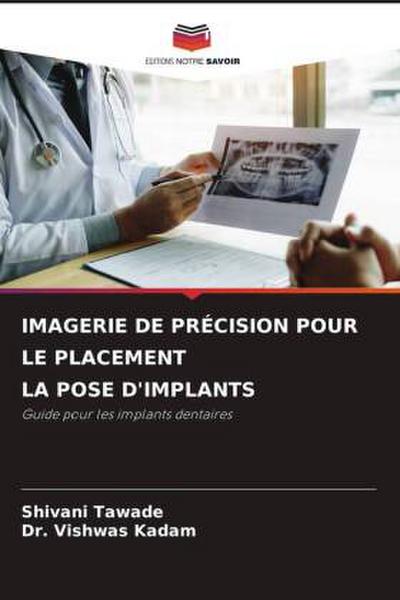 IMAGERIE DE PRÉCISION POUR LE PLACEMENT LA POSE D’IMPLANTS