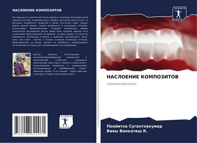 NASLOENIE KOMPOZITOV