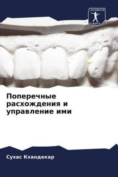 Poperechnye rashozhdeniq i uprawlenie imi