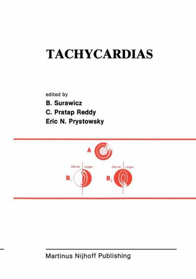 Tachycardias