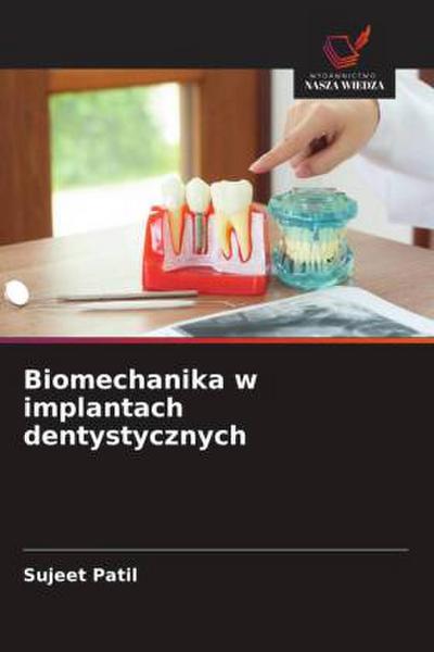 Biomechanika w implantach dentystycznych