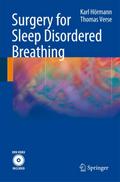 Surgery for Sleep Disordered Breathing