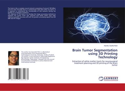 Brain Tumor Segmentation using 3D Printing Technology