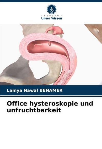 Office hysteroskopie und unfruchtbarkeit