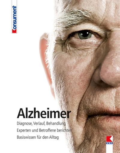 Alzheimer