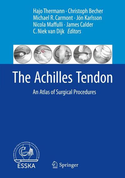 The Achilles Tendon