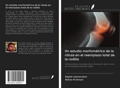 Un estudio morfométrico de la rótula en el reemplazo total de la rodilla