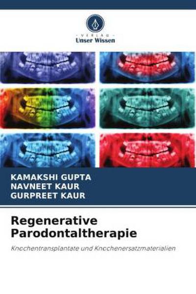 Regenerative Parodontaltherapie