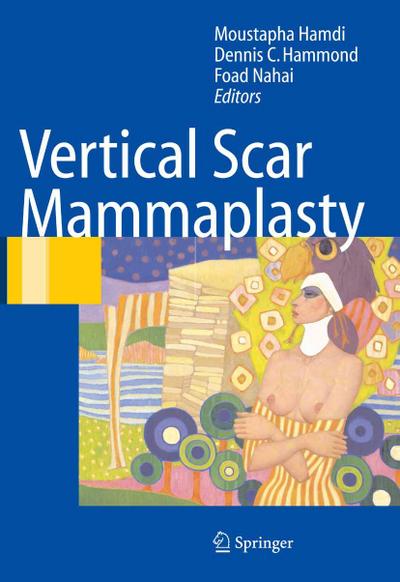 Vertical Scar Mammaplasty