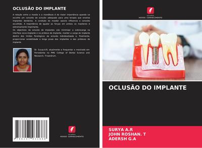 OCLUSÃO DO IMPLANTE