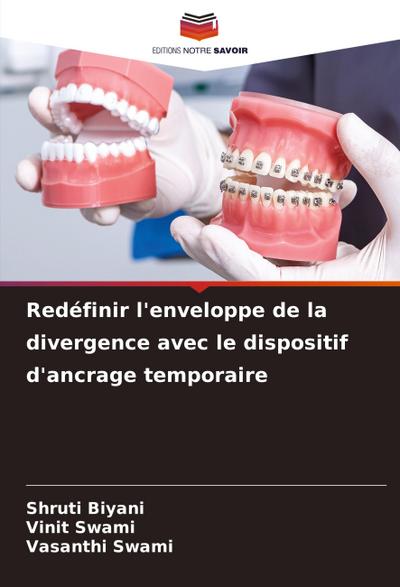 Redéfinir l’enveloppe de la divergence avec le dispositif d’ancrage temporaire