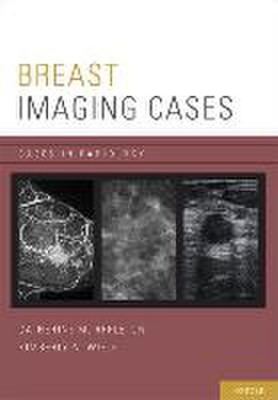 Breast Imaging Cases Casrad P