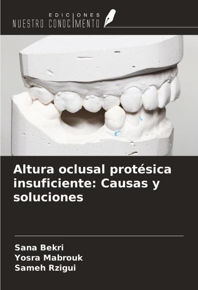Altura oclusal protésica insuficiente: Causas y soluciones