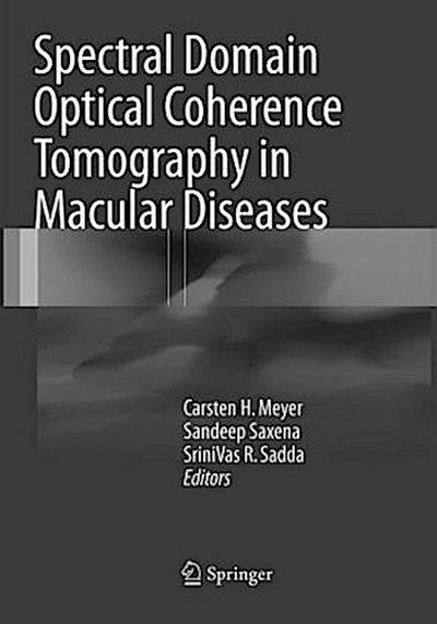 Spectral Domain Optical Coherence Tomography in Macular Diseases