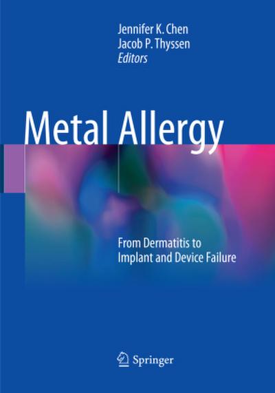 Metal Allergy