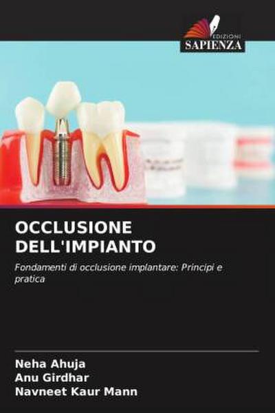 OCCLUSIONE DELL’IMPIANTO