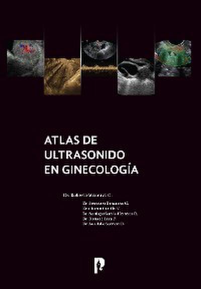 Atlas de ultrasonido en ginecología