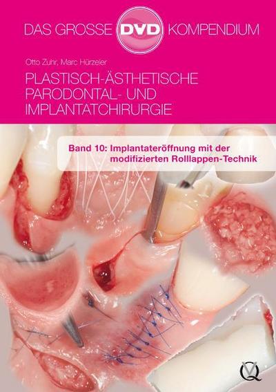 Plastisch-Ästhetische Parodontal- und Implantatchirurgie / Plastisch-Ästhetische Parodontal- und Implantatchirurgie