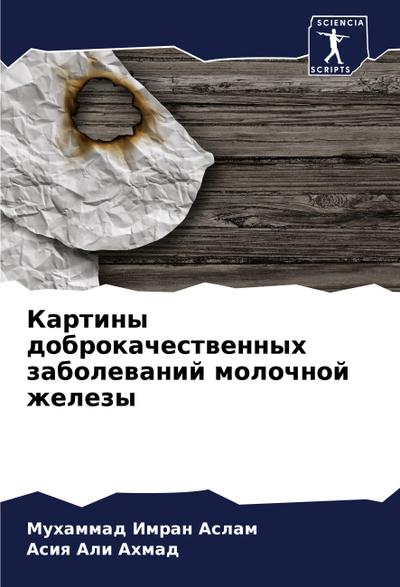 Kartiny dobrokachestwennyh zabolewanij molochnoj zhelezy
