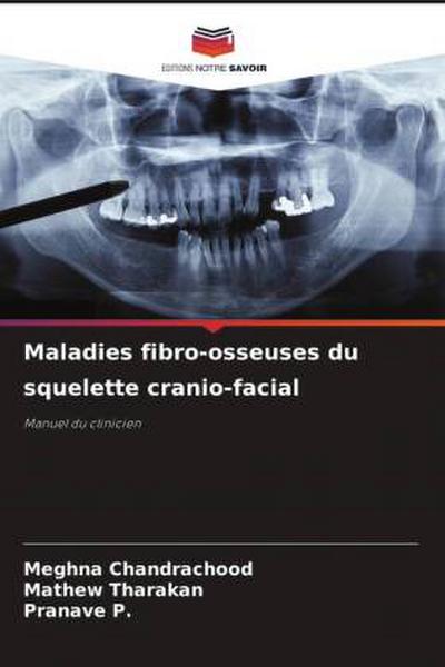 Maladies fibro-osseuses du squelette cranio-facial
