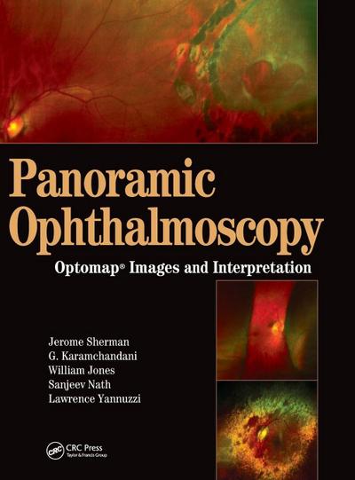 Panoramic Ophthalmoscopy