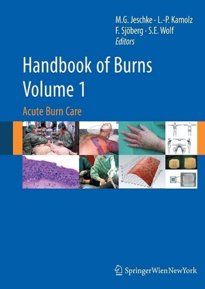 Handbook of Burns Volume 1