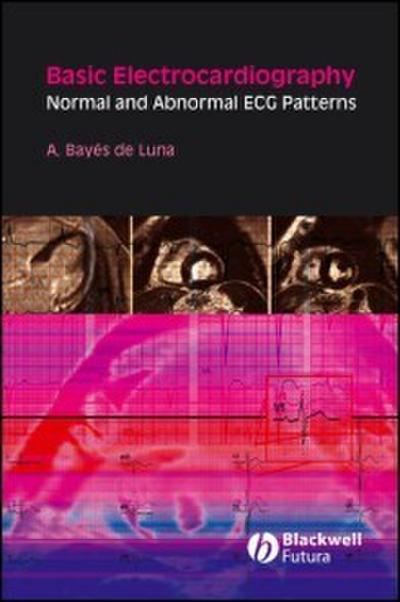 Basic Electrocardiography
