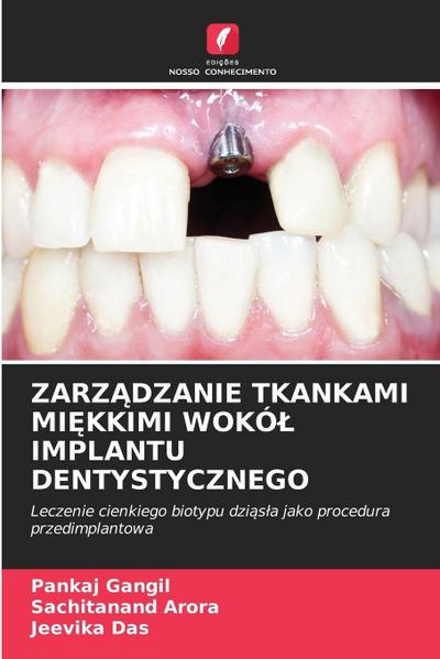 ZARZ¿DZANIE TKANKAMI MI¿KKIMI WOKÓ¿ IMPLANTU DENTYSTYCZNEGO