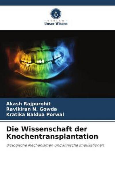Die Wissenschaft der Knochentransplantation