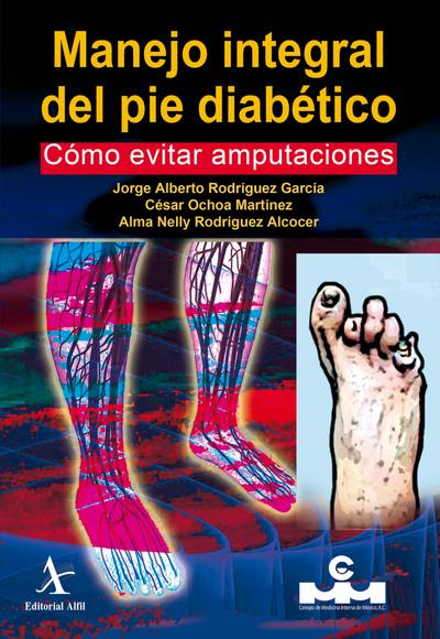 Manejo integral del pie diabético. Cómo evitar amputaciones