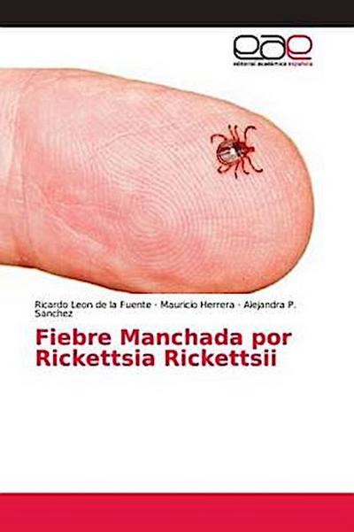 Fiebre Manchada por Rickettsia Rickettsii