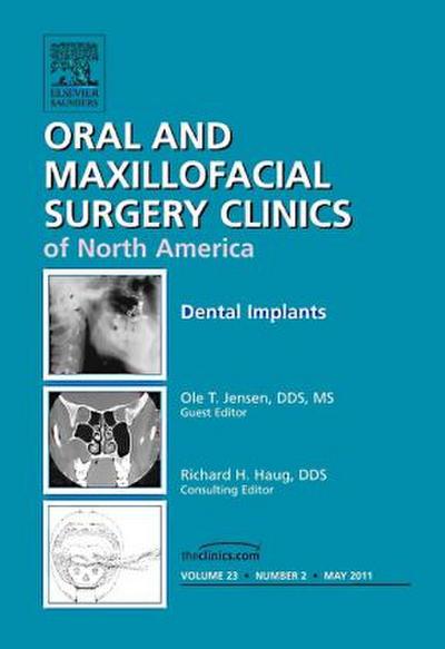 Dental Implants, an Issue of Oral and Maxillofacial Surgery Clinics