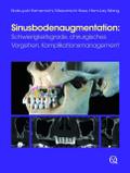 Sinusbodenaugmentation von Nobuyuki Yamamichi | Ebook