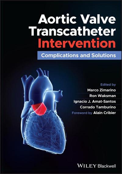 Aortic Valve Transcatheter Intervention