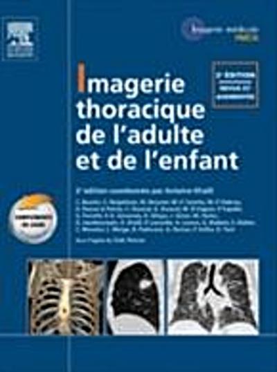 Imagerie thoracique de l’’enfant et de l’’adulte