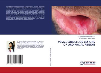 VESICULOBULLOUS LESIONS OF ORO-FACIAL REGION