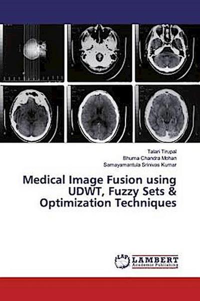 Medical Image Fusion using UDWT, Fuzzy Sets & Optimization Techniques