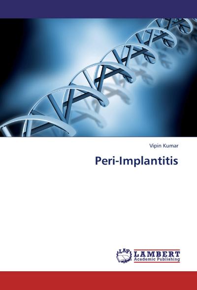 Peri-Implantitis