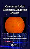 Computer-Aided Glaucoma Diagnosis System