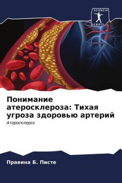 Ponimanie ateroskleroza: Tihaq ugroza zdorow’ü arterij