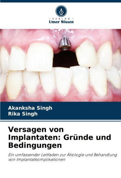 Versagen von Implantaten: Gründe und Bedingungen