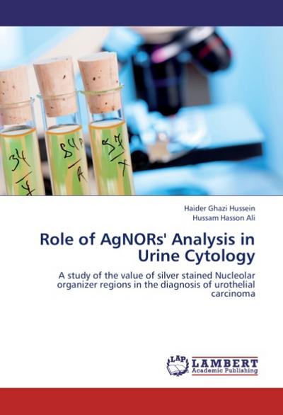 Role of AgNORs’ Analysis in Urine Cytology