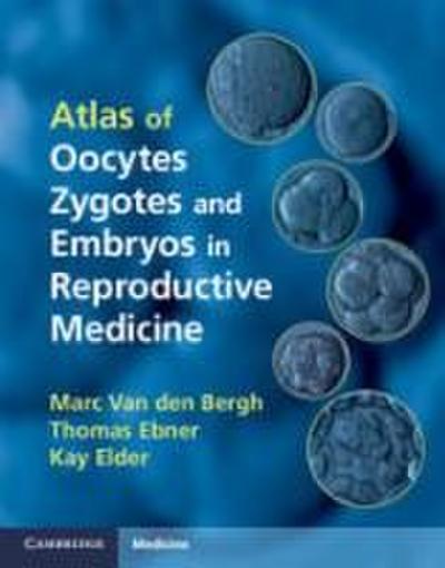 Atlas of Oocytes, Zygotes and Embryos in Reproductive Medicine Hardback