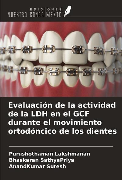 Evaluación de la actividad de la LDH en el GCF durante el movimiento ortodóncico de los dientes