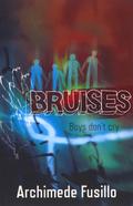 Bruises