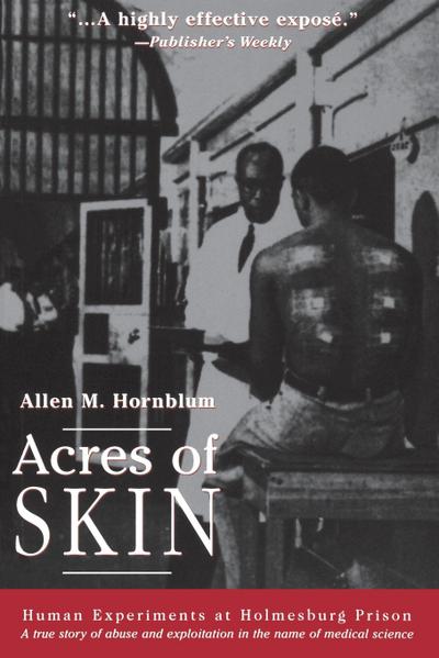 Acres of Skin